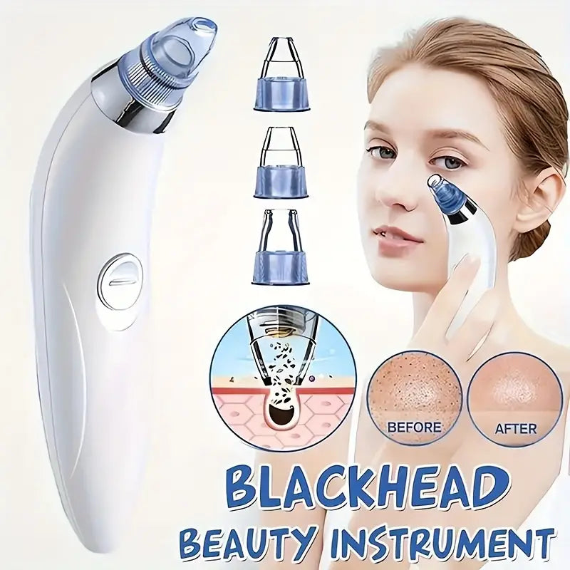 Electric Blackhead Remover Instrument, Portable Facial Pore Cleansing Beauty Device, Gentle & Safe for Blackhead Removal, with 4 Suction Tips, Battery-Powered (No Battery Included)